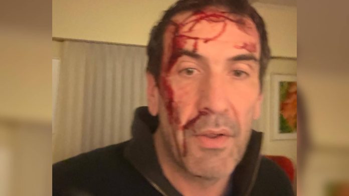 Habló el legislador libertario de Neuquén que sufrió un violento robo en la previa de las elecciones: qué se sabe sobre el caso